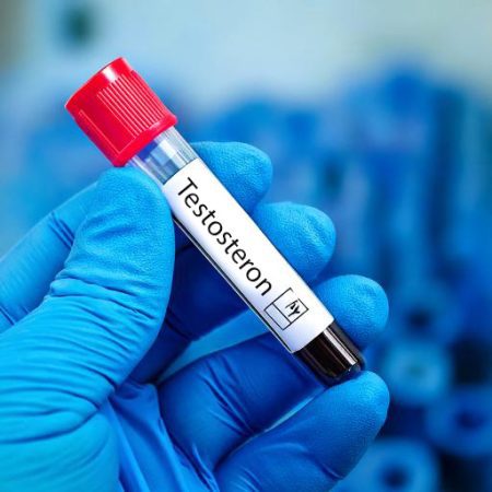 Testosteronmangel Testosteronmangel Blutuntersuchung im Labor
